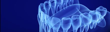 3d-scan