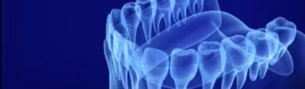 3d-scan