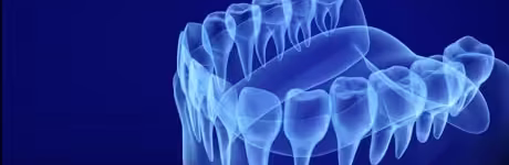 3d-scan