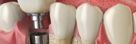 Οστική και Ιστική Ανάπλαση